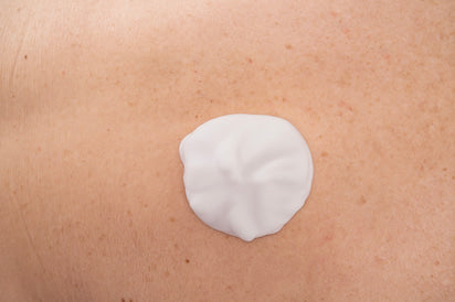 Molicare SKIN Spuma Pentru Curatarea Pielii Pacientilor Cu Incontinenta sau Colostomie